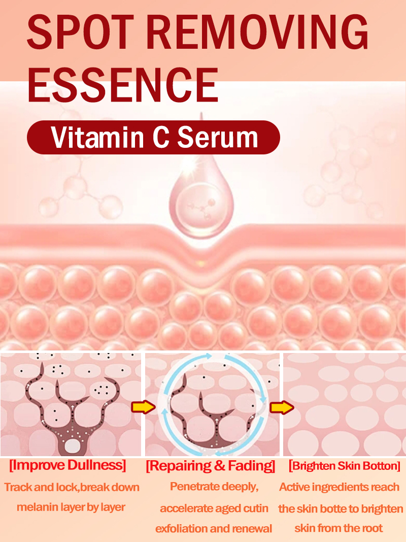 Lighten Freckles Melasma, Faci - огляд і ціна Skincare Luxury Whitening
